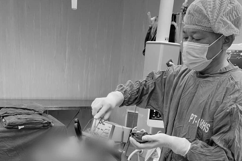 Lưỡi kéo dài 19cm cắm trong sọ não nam thanh niên - 2 Lưỡi kéo dài 19cm cắm trong sọ não nam thanh niên - 2