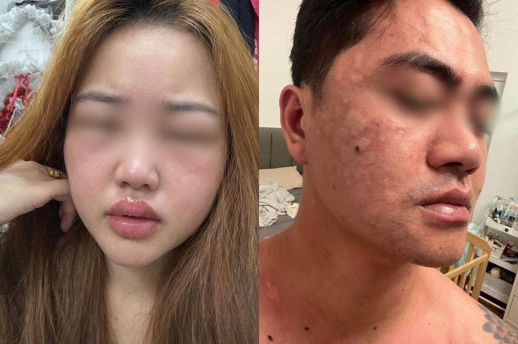 Món bánh trứng kiến gây sốt: Nhiều người dị ứng ngay sau khi thử - 1