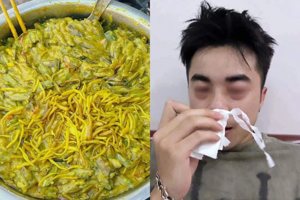 Chàng trai Hà Nội sưng mắt, khó thở vì món đặc sản khổ trước, sướng sau - 3