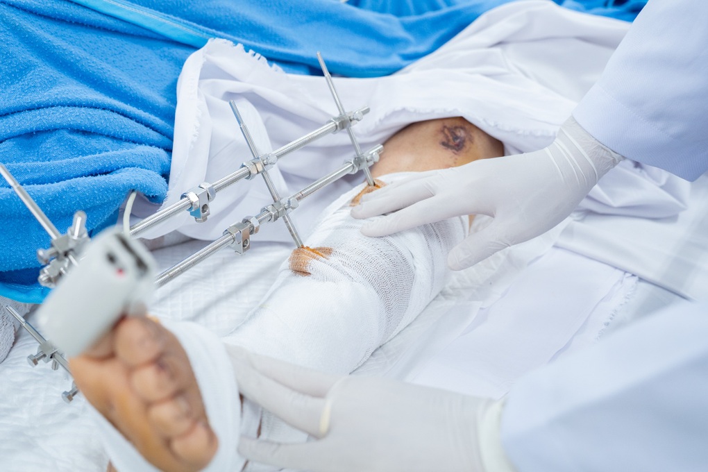 Vụ xe khách lao xuống vực, 15 người thương vong: Xuyên đêm cấp cứu nạn nhân - 1 Vụ xe khách lao xuống vực, 15 người thương vong: Xuyên đêm cấp cứu nạn nhân - 1