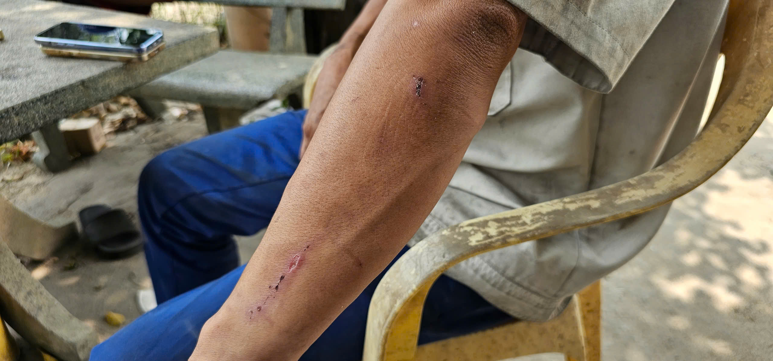 Chủ gara ở Củ Chi tố bị hàng xóm hành hung sau khi hỏi tiền sửa xe- Ảnh 3.