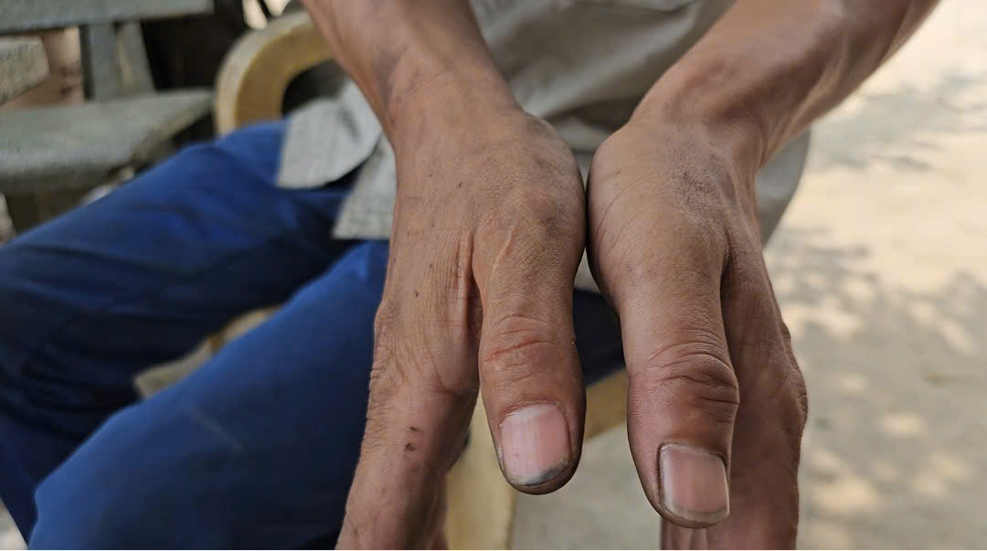 Chủ gara ở Củ Chi tố bị hàng xóm hành hung sau khi hỏi tiền sửa xe- Ảnh 4.