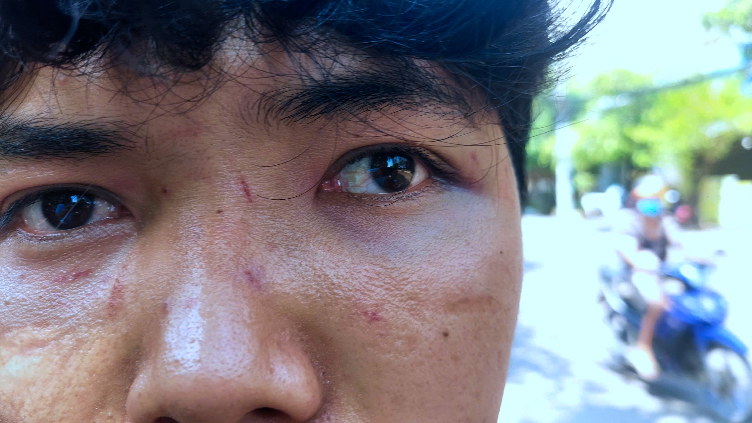 Hành hung người bán bánh bèo ở Quy Nhơn 2026: Câu chuyện đau lòng từ phường Quy Nhơn Nam - Ảnh 3.