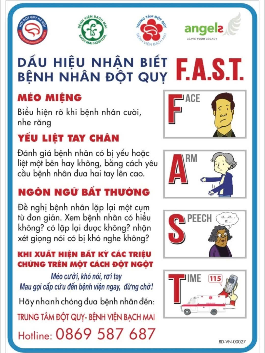 Chuyên gia cảnh báo dấu hiệu mờ nhạt trước cơn đột quỵ - Ảnh 2. đột quỵ - Ảnh 2.